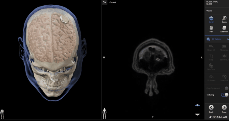脑机接口2024年近况汇总与简单介绍